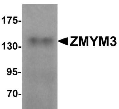 Western Blot: ZMYM3 Antibody [NBP1-76525] - Human brain tissue lysate with ZMYM3 antibody at 1 ug/mL.