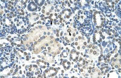 Immunohistochemistry: ZMYND11 Antibody [NBP2-86909] - Human kidney