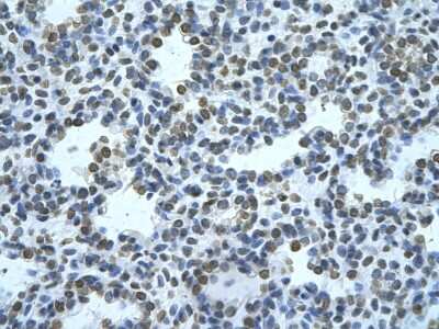 Immunohistochemistry-Paraffin: ZMYND11 Antibody [NBP2-86909] - Rabbit Anti-ZMYND11 Antibody. Paraffin Embedded Tissue: Human alveolar cell. Cellular Data: Epithelial cells of renal tubule. Antibody Concentration: 4.0-8.0 ug/ml. Magnification: 400X