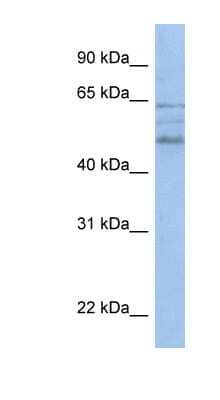 Western Blot ZMYND17 Antibody - BSA Free