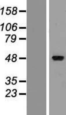 Western Blot ZMYND17 Overexpression Lysate