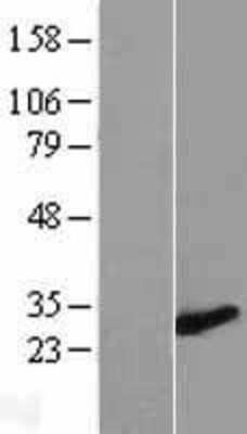 Western Blot ZMYND19 Overexpression Lysate