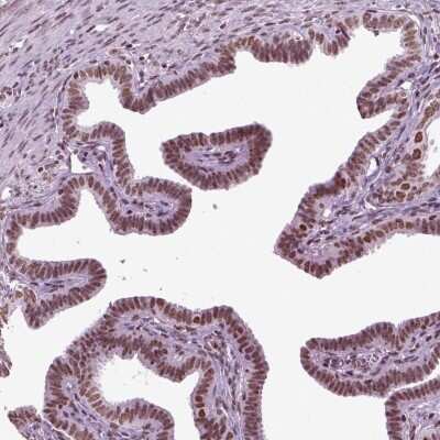 Immunohistochemistry ZNDR1 Antibody - BSA Free
