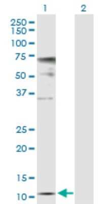 Western Blot: ZNDR1 Antibody [H00030834-D01P] - Analysis of ZNRD1 expression in transfected 293T cell line by ZNRD1 polyclonal antibody.Lane 1: ZNRD1 transfected lysate(13.90 KDa).Lane 2: Non-transfected lysate.