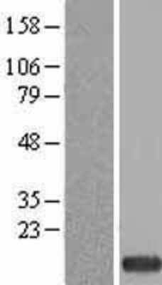 Western Blot: ZNDR1 Overexpression Lysate (Adult Normal) [NBL1-18262] Left-Empty vector transfected control cell lysate (HEK293 cell lysate); Right -Over-expression Lysate for ZNDR1.