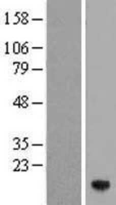 Western Blot: ZNDR1 Overexpression Lysate (Adult Normal) [NBP2-10313] Left-Empty vector transfected control cell lysate (HEK293 cell lysate); Right -Over-expression Lysate for ZNDR1.
