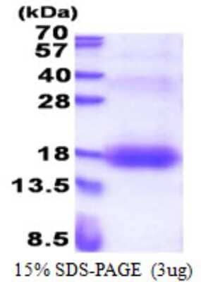SDS-Page: ZNDR1 Protein [NBP2-22963]