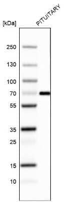 Western Blot: ZNF10 Antibody (CL9744) [NBP2-88939] - Analysis in human pituitary gland tissue.