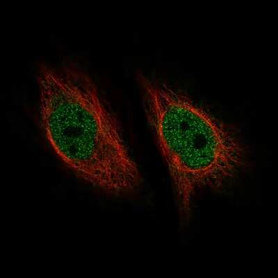 Immunocytochemistry/Immunofluorescence: ZNF10 Antibody (CL9747) [NBP2-88940] - Staining of HeLa cells using the Anti-ZNF10 monoclonal antibody, showing specific staining in the nucleoplasm in green. Microtubule- and nuclear probes are visualized in red and blue, respectively (where available).