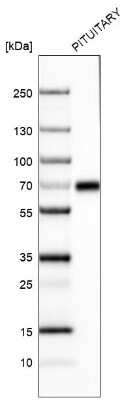 Western Blot: ZNF10 Antibody (CL9747) [NBP2-88940] - Analysis in human pituitary gland tissue.