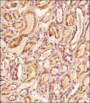 Immunohistochemistry-Paraffin ZNF10 Antibody - BSA Free