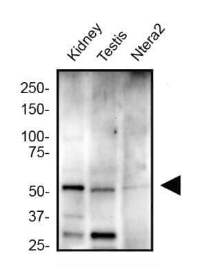 Western Blot ZNF10 Antibody - BSA Free