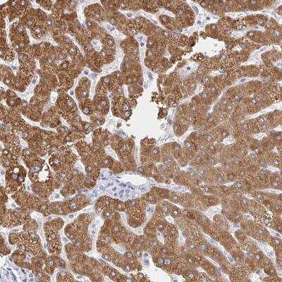 Immunohistochemistry-Paraffin ZNF100 Antibody - BSA Free