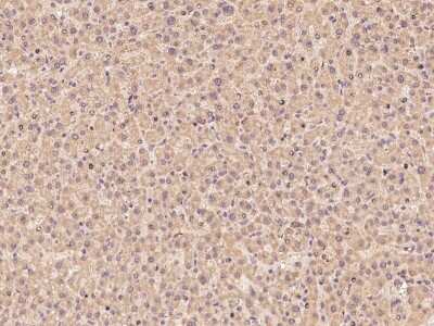 Immunohistochemistry-Paraffin ZNF100 Antibody - BSA Free