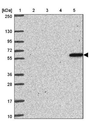Western Blot ZNF100 Antibody - BSA Free