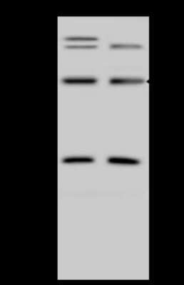 Western Blot ZNF100 Antibody - BSA Free
