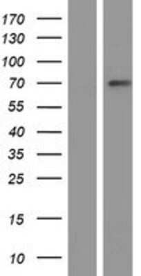 Western Blot: ZNF100 Overexpression Lysate (Adult Normal) [NBP2-05109] Left-Empty vector transfected control cell lysate (HEK293 cell lysate); Right -Over-expression Lysate for ZNF100.