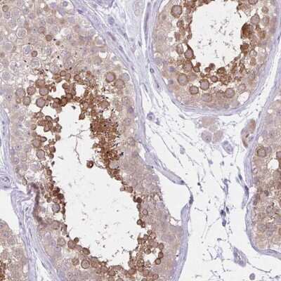 Immunohistochemistry-Paraffin: ZNF101 Antibody [NBP2-33755] - Staining of human testis shows strong cytoplasmic positivity in cells in a subset of cells in seminiferus ducts.