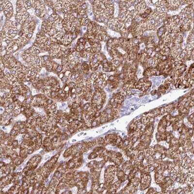 Immunohistochemistry-Paraffin ZNF101 Antibody - BSA Free