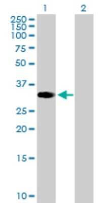 Western Blot: ZNF101 Antibody [H00094039-B01P] - Analysis of ZNF101 expression in transfected 293T cell line by ZNF101 polyclonal antibody.  Lane 1: ZNF101 transfected lysate(34.76 KDa). Lane 2: Non-transfected lysate.