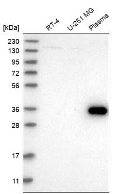 Western Blot ZNF101 Antibody - BSA Free