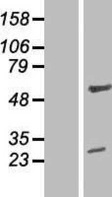 Western Blot ZNF101 Overexpression Lysate