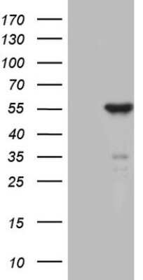 Western Blot: ZNF114 Antibody (6F4) [NBP2-46416] - Analysis of HEK293T cells were transfected with the pCMV6-ENTRY control (Left lane) or pCMV6-ENTRY ZNF114.