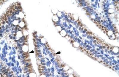 Immunohistochemistry-Paraffin ZNF12 Antibody - BSA Free