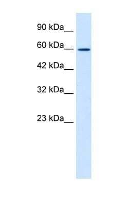 Western Blot ZNF12 Antibody - BSA Free