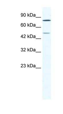 Western Blot: ZNF12 Antibody [NBP1-80276] - Jurkat cell lysate, concentration 1.25ug/ml.
