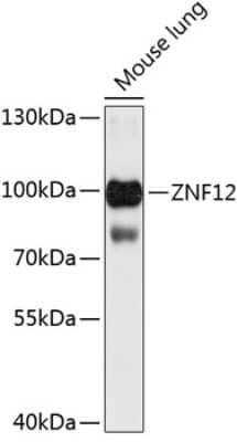 Western Blot: ZNF12 Antibody [NBP2-94653] - Analysis of extracts of mouse kidney, using ZNF12 at 1:3000 dilution.Secondary antibody: HRP Goat Anti-Rabbit IgG (H+L) at 1:10000 dilution.Lysates/proteins: 25ug per lane.Blocking buffer: 3% nonfat dry milk in TBST.Detection: ECL Basic Kit .Exposure time: 30s.