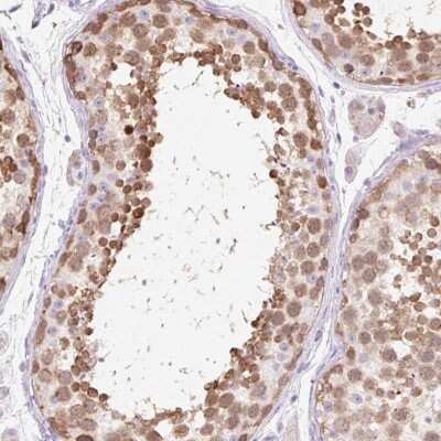 Immunohistochemistry ZNF121 Antibody - BSA Free