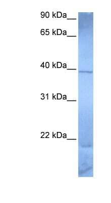 Western Blot: ZNF121 Antibody [NBP1-79350] - Jurkat cell lysate, concentration 0.2-1 ug/ml.