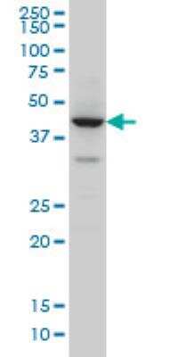 Western Blot: ZNF124 Antibody (4G4) [H00007678-M01] - ZNF124 monoclonal antibody (M01), clone 4G4. Western Blot analysis of ZNF124 expression in Raw 264.7.