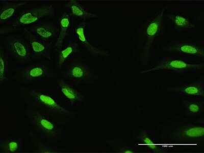 Immunocytochemistry/Immunofluorescence: ZNF124 Antibody [H00007678-D01P] - Analysis of antibody to ZNF124 on HeLa cell. Antibody concentration 10 ug/ml.