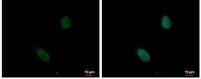 Immunocytochemistry/Immunofluorescence: ZNF124 Antibody [NBP2-20961] -  HeLa cells were fixed in 4% paraformaldehyde at RT for 15 min. Green: ZNF124 protein stained by ZNF124 antibody diluted at 1:500. Blue: Hoechst 33342 staining.Scale bar = 10 um.