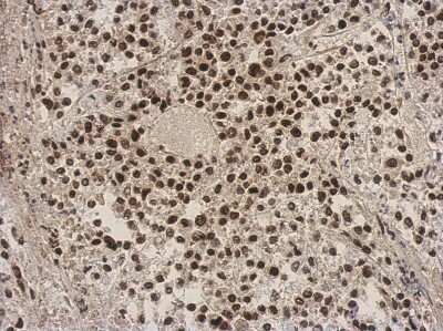 Immunohistochemistry-Paraffin: ZNF124 Antibody [NBP2-20961] - Immunohistochemical analysis of paraffin-embedded D54MG xenograft, using antibody at 1:500 dilution.