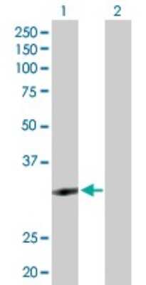 Western Blot: ZNF124 Antibody [H00007678-D01P] - Analysis of ZNF124 expression in transfected 293T cell line by ZNF124 polyclonal antibody.Lane 1: ZNF124 transfected lysate(33.30 KDa).Lane 2: Non-transfected lysate.