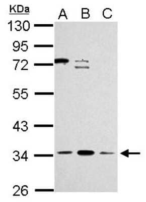 Western Blot: ZNF124 Antibody [NBP2-20961] - Sample (30 ug of whole cell lysate) A: Jurkat B: Raji C: K562 10% SDS PAGE gel, diluted at 1:2000.
