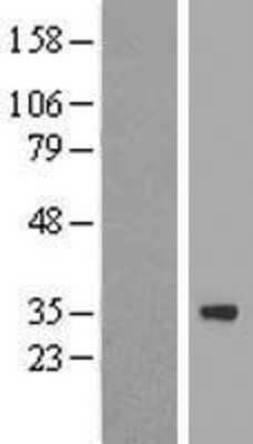 Western Blot: ZNF124 Overexpression Lysate (Adult Normal) [NBP2-08010] Left-Empty vector transfected control cell lysate (HEK293 cell lysate); Right -Over-expression Lysate for ZNF124.