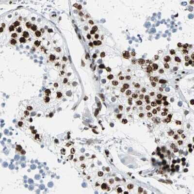 Immunohistochemistry: ZNF131 Antibody [NBP2-48505] - Staining of human testis shows strong nuclear positivity in cells in seminiferus ducts.