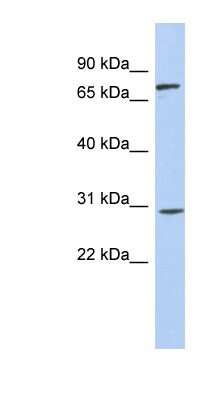 Western Blot: ZNF131 Antibody [NBP1-79227] - Human Small Intestine, concentration 0.2-1 ug/ml.