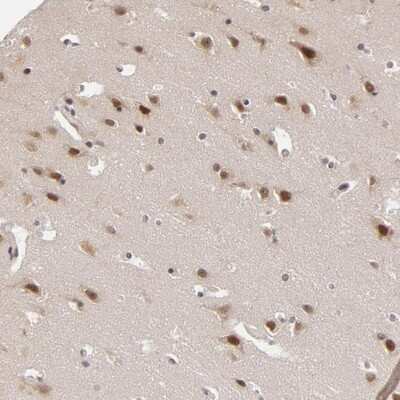 Immunohistochemistry-Paraffin ZNF133 Antibody - BSA Free