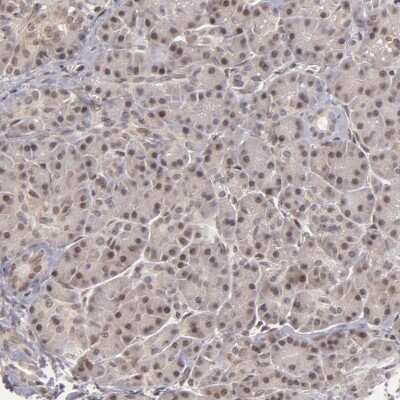 Immunohistochemistry-Paraffin ZNF133 Antibody - BSA Free