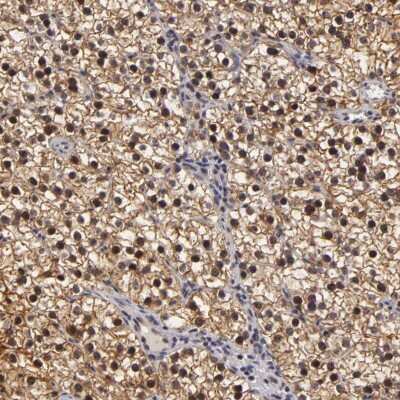 Immunohistochemistry-Paraffin ZNF133 Antibody - BSA Free