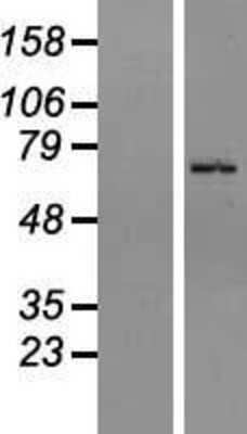 Western Blot ZNF133 Overexpression Lysate