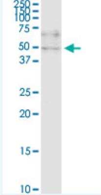 Western Blot: ZNF134 Antibody (2D10) [H00007693-M03-100ug] - Monoclonal antibody (M03), clone 2D10. Western Blot analysis of ZNF134 expression in Hela S3 NE.