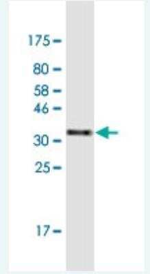 Western Blot: ZNF134 Antibody (2D10) [H00007693-M03-100ug] - Detection against Immunogen (35.53 KDa) 