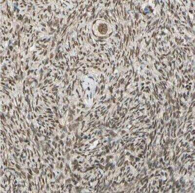 Immunohistochemistry-Paraffin ZNF135 Antibody - BSA Free