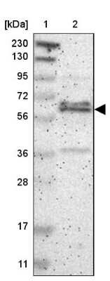 Western Blot ZNF135 Antibody - BSA Free